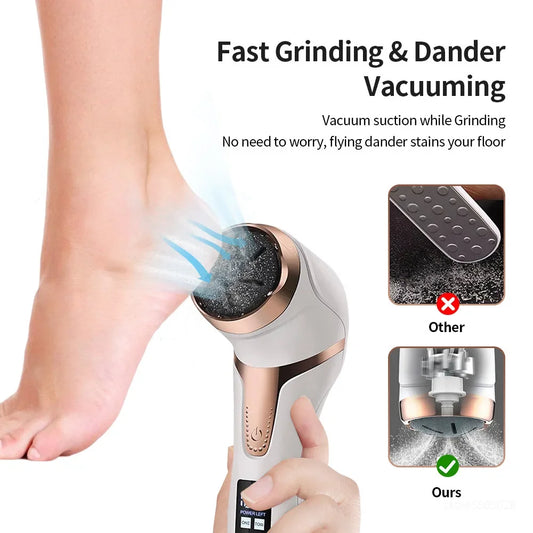 Electric Foot File Callus Remover – Rechargeable Pedicure Machine for Cracked Heels & Dead Skin
