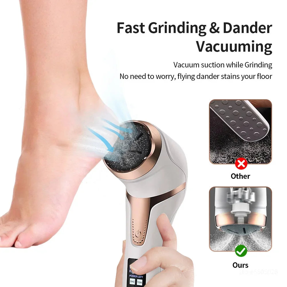 electric callus remover for feet